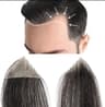 Mesa Adeziva pentru Alopecie